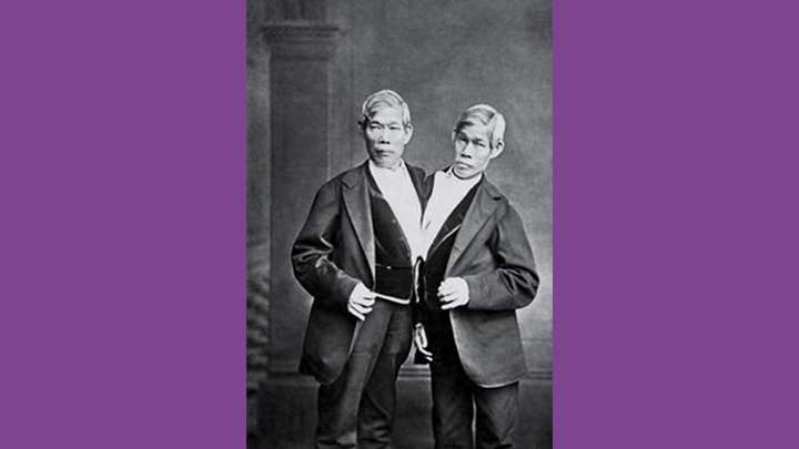 The Original Siamese Twins: An American Story