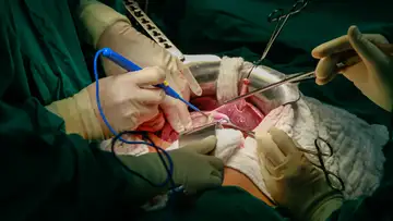 Notes from a Transplant Surgeon