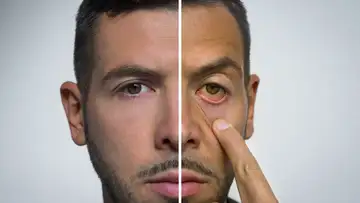 Language of Skin