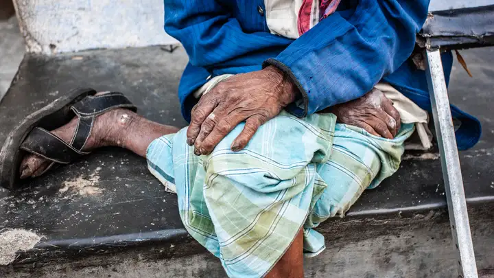 A Prison and a Haven: America's Only Leprosy Colony