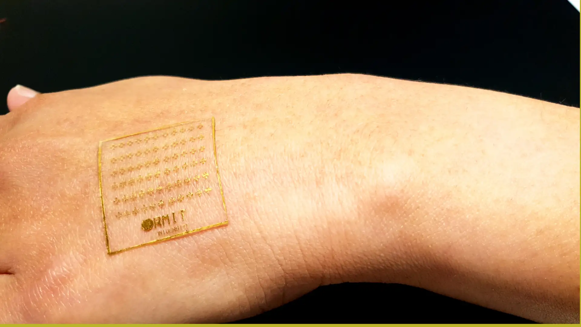 Artificial Skin