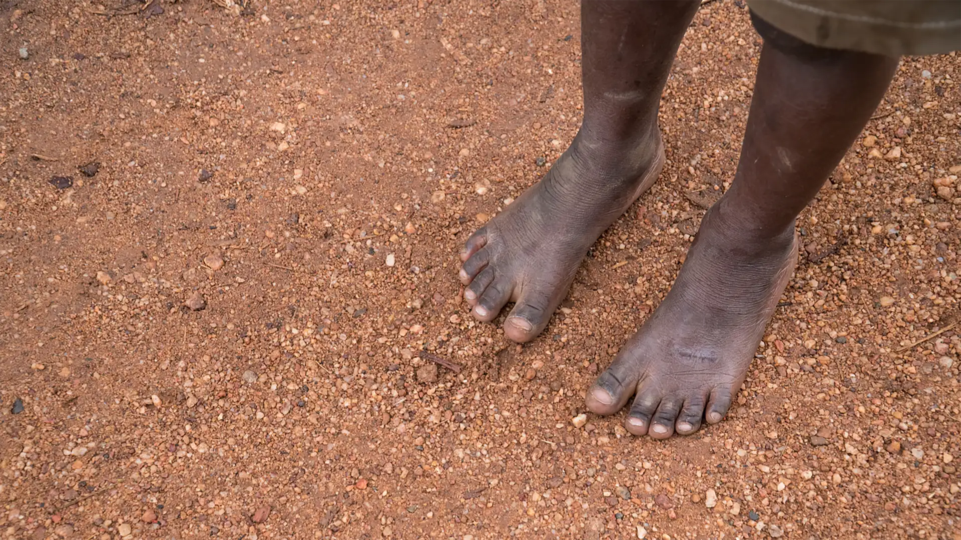 Congo Sole