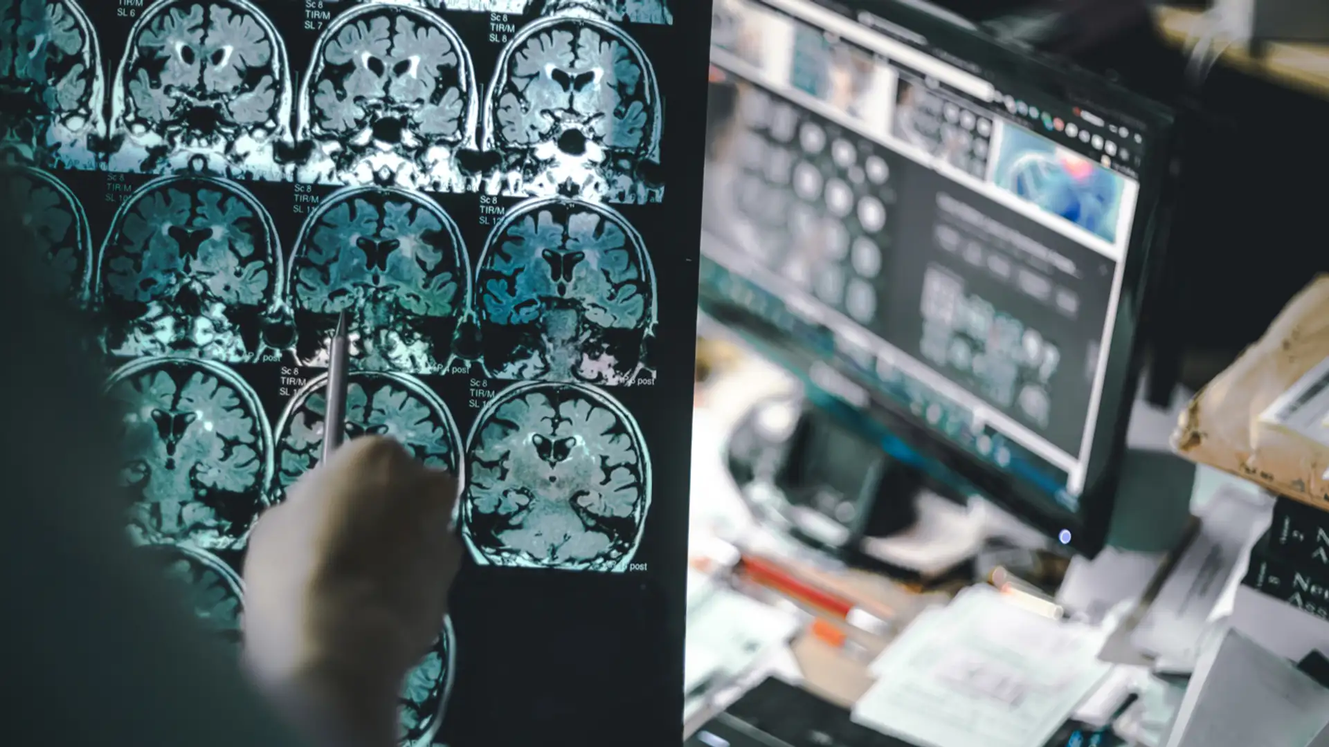 New Alzheimer’s Drug