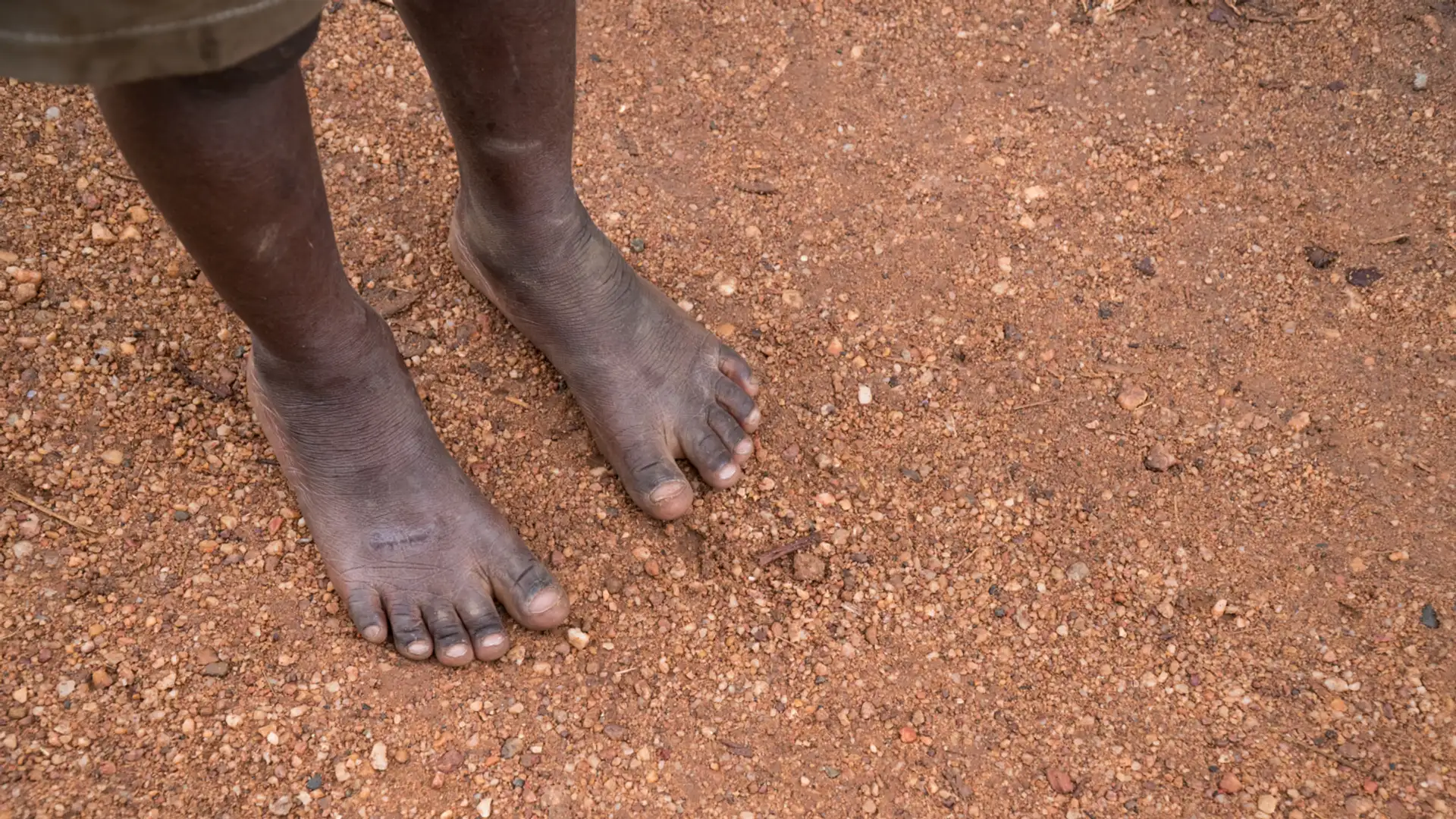 A Refugee’s Story
