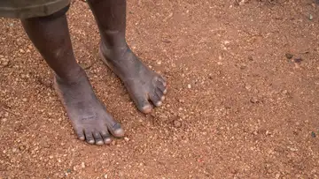 A Refugee’s Story