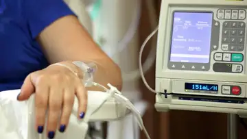 Lupus Chemotherapy