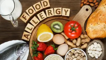 Food Allergies