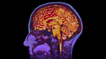 The Benefits of Forgetting
