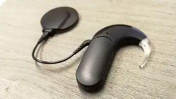 Cochlear Implants