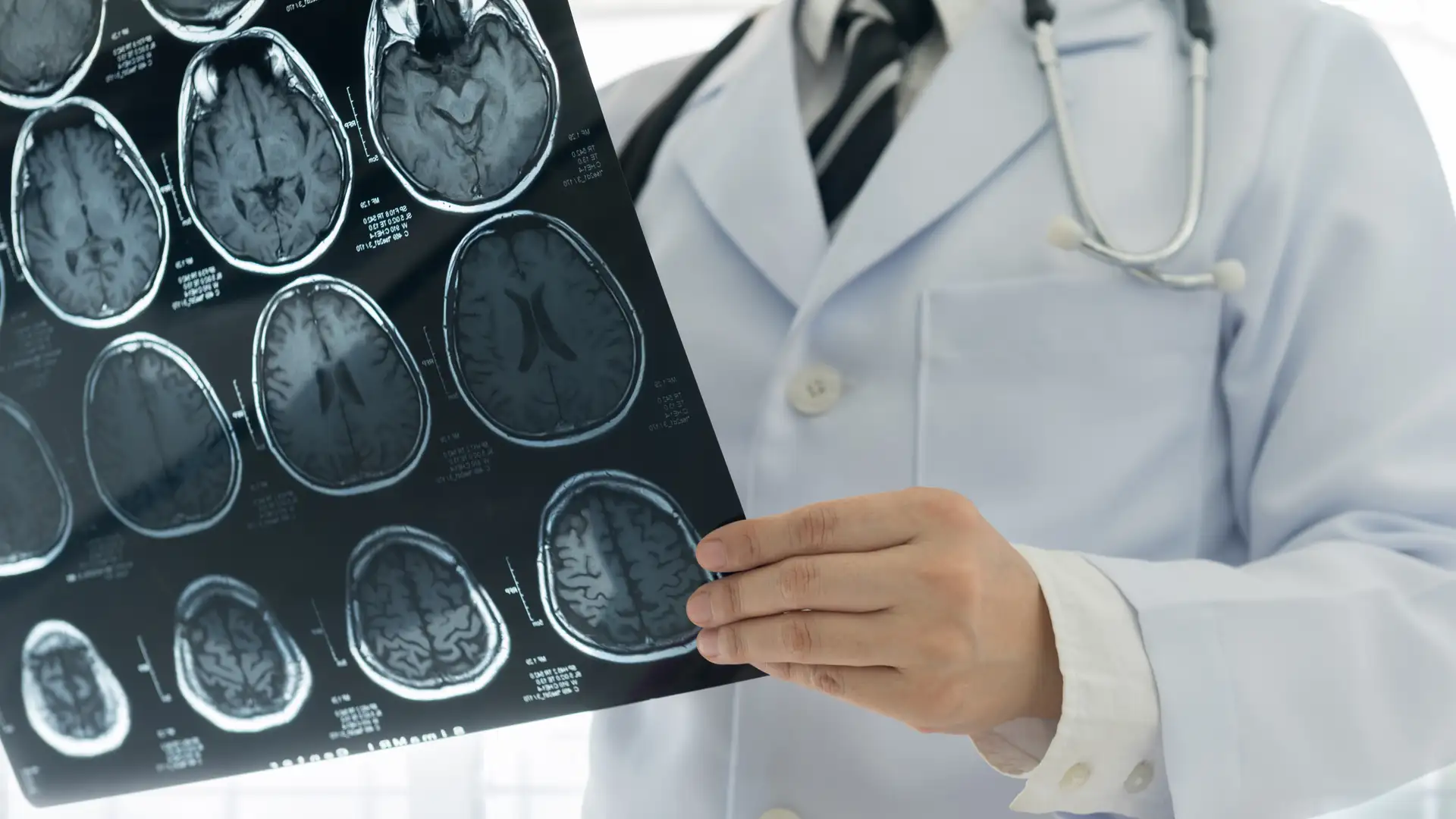 Crime & Brain Injury, CTE & Contact Sports, Oldest Stardust, Solar Storms